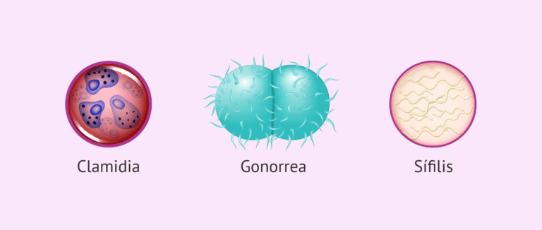 Infecciones de Transmisión Sexual (ITS)